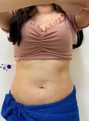 After Inshape